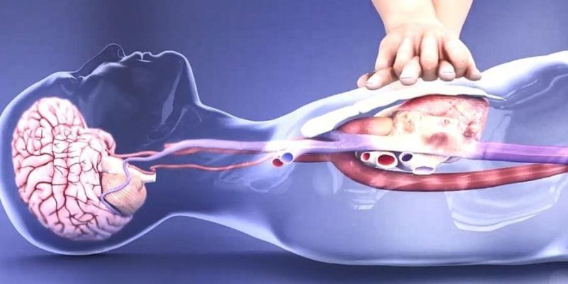 Khái quát nội dung tóm tắt về Cpr là gì